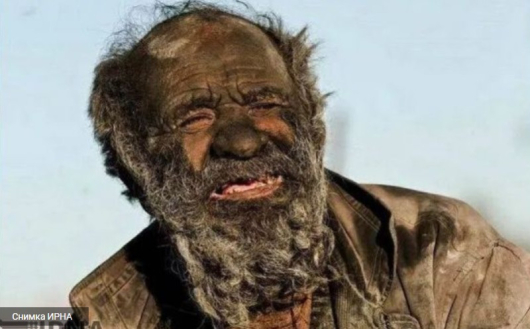 На 94-годишна възраст почина иранецът, известен като най-мръсния човек в